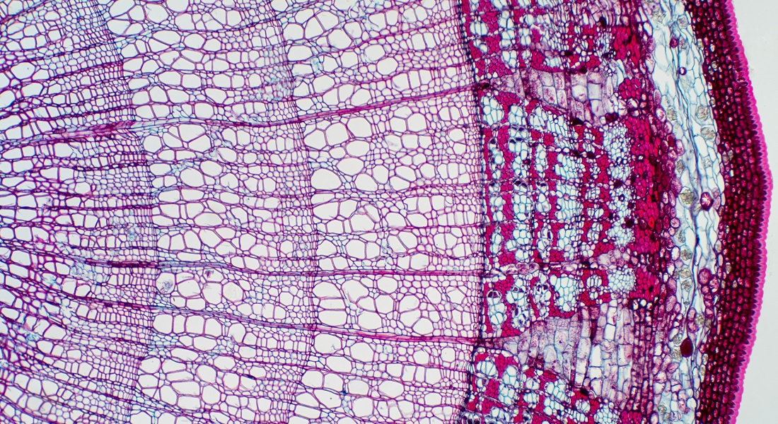 Cross section of xylem (credit: Getty Images)