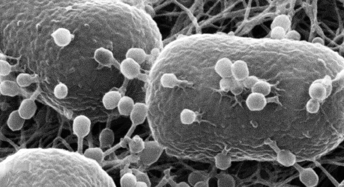 mikrografisk billede af fager der angriber bakterien Escherichia coli